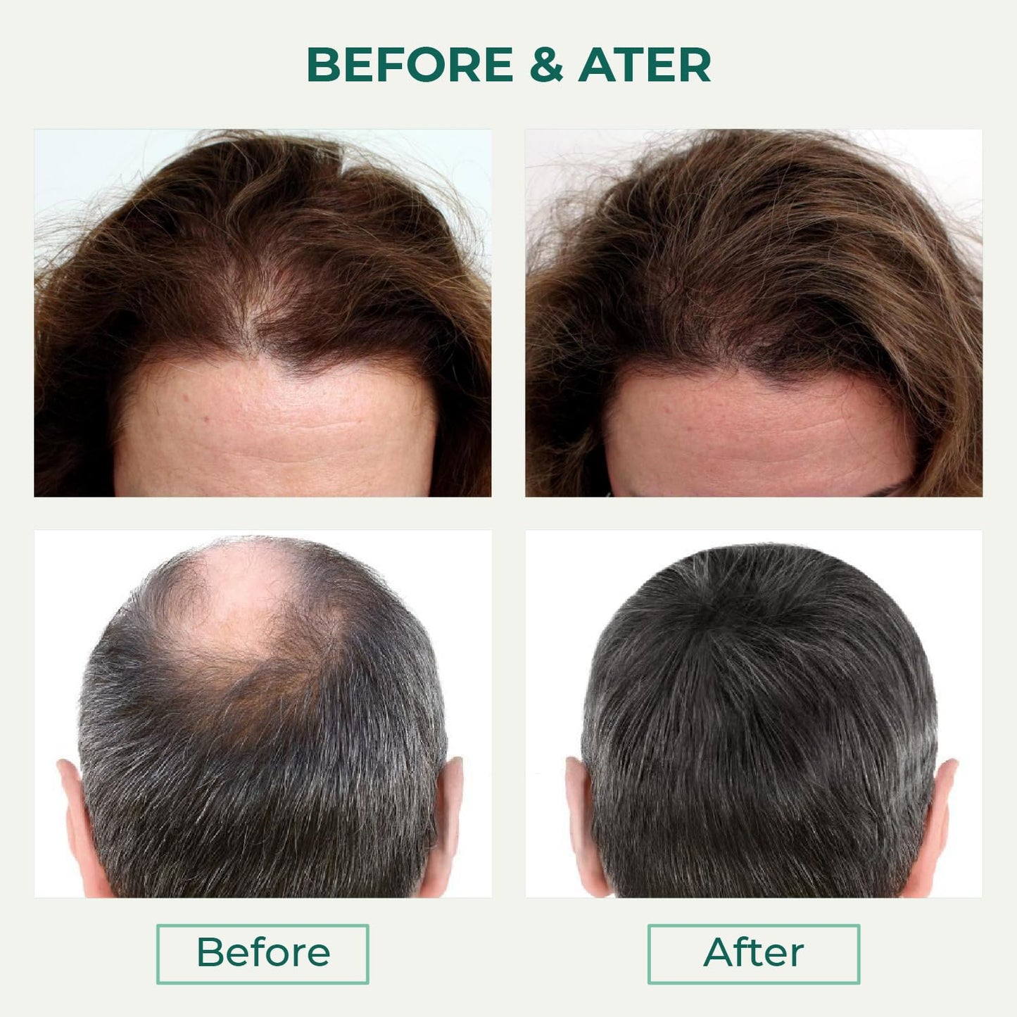Thik&Fix Hair Loss Conditioner